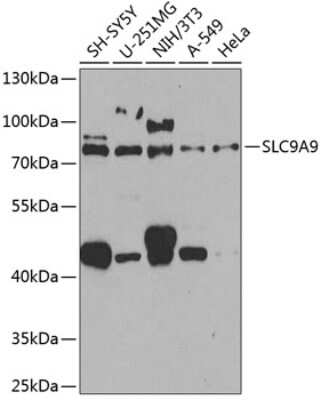 Western Blot SLC9A9 Antibody - BSA Free