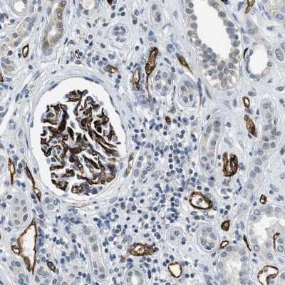 Immunohistochemistry-Paraffin: SLCO2A1 Antibody [NBP2-13349] - Immunohistochemical staining of human kidney shows strong membranous positivity in cells in glomeruli and endothelial cells.