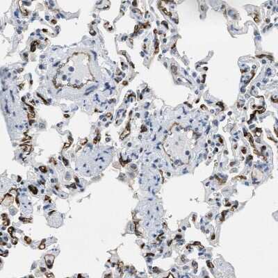 Immunohistochemistry-Paraffin: SLCO2A1 Antibody [NBP2-13349] - Immunohistochemical staining of human lung shows strong membranous positivity in endothelial cells.