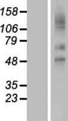 Western Blot: SLCO2A1 Overexpression Lysate (Adult Normal) [NBL1-16205] Left-Empty vector transfected control cell lysate (HEK293 cell lysate); Right -Over-expression Lysate for SLCO2A1.