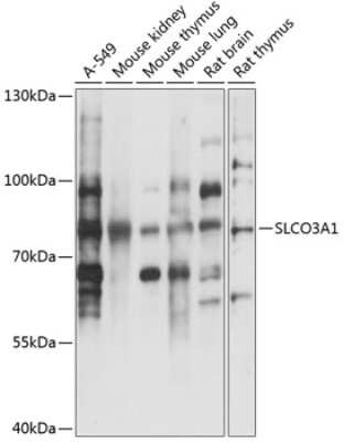 Western Blot: SLCO3A1 Antibody [NBP3-05037] - Analysis of extracts of various cell lines, using SLCO3A1 antibody at 1:3000 dilution. Secondary antibody: HRP Goat Anti-Rabbit IgG (H+L) at 1:10000 dilution. Lysates/proteins: 25ug per lane. Blocking buffer: 3% nonfat dry milk in TBST. Detection: ECL Basic Kit