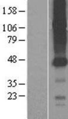 Western Blot SLCO4C1 Overexpression Lysate