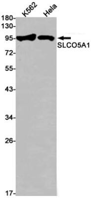 Western Blot: SLCO5A1 Antibody (S02-5J4) [NBP3-19774] - Western blot detection of SLCO5A1 in K562, Hela cell lysates using NBP3-19774 (1:1000 diluted). Predicted band size: 92kDa. Observed band size: 92kDa.