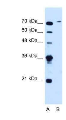 Western Blot: SLCO6A1 Antibody [NBP1-59899] - Jurkat cell lysate, concentration 1.25ug/ml.