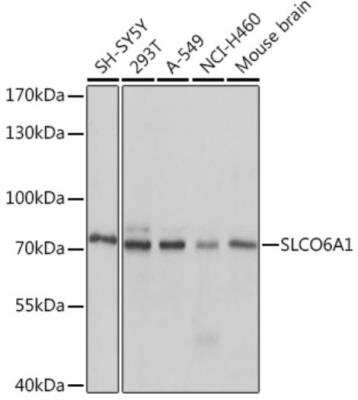 Western Blot: SLCO6A1 Antibody [NBP2-95132] - Western blot analysis of extracts of various cell lines, using SLCO6A1 antibody at 1:1000 dilution. Secondary antibody: HRP Goat Anti-Rabbit IgG (H+L) at 1:10000 dilution. Lysates/proteins: 25ug per lane. Blocking buffer: 3% nonfat dry milk in TBST.Detection: ECL Basic Kit. Exposure time: 1s.