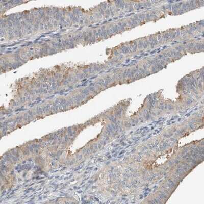 Immunohistochemistry-Paraffin: SLFN12L Antibody [NBP1-91060] - Staining of human fallopian tube shows moderate cytoplasmic positivity in glandular cells.