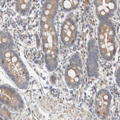 Immunohistochemistry-Paraffin: SLFN12L Antibody [NBP1-91060] - Staining of human gastrointestinal shows moderate cytoplasmic positivity in glandular cells.