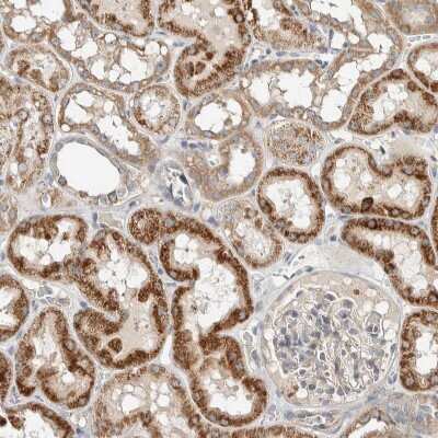 Immunohistochemistry-Paraffin: SLFN12L Antibody [NBP1-91060] - Staining of human kidney shows strong cytoplasmic positivity in cells in tubules.