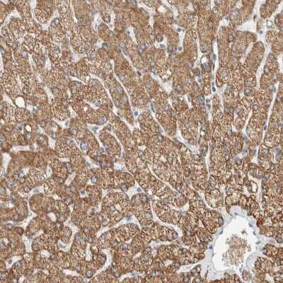 Immunohistochemistry-Paraffin: SLFN12L Antibody [NBP1-91060] - Staining of human liver shows strong cytoplasmic positivity in hepatocytes.
