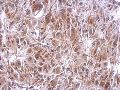 Immunohistochemistry-Paraffin: SLFNL1 Antibody [NBP2-20397] - U373 xenograft, using SLFNL1 antibody [N2C2], Internal antibody at 1:500 dilution. Antigen Retrieval: Trilogy™ (EDTA based, pH 8.0) buffer, 15min. 