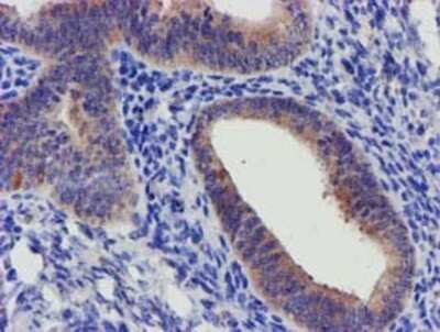 Immunohistochemistry: SLFNL1 Antibody (OTI1G2) - Azide and BSA Free [NBP2-74223] - Staining of paraffin-embedded Human endometrium tissue using anti-SLFNL1 mouse monoclonal antibody.