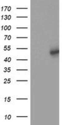 Western Blot: SLFNL1 Antibody (OTI1G2) - Azide and BSA Free [NBP2-74223] - HEK293T cells were transfected with the pCMV6-ENTRY control (Left lane) or pCMV6-ENTRY SLFNL1 (Right lane) cDNA for 48 hrs and lysed. Equivalent amounts of cell lysates (5 ug per lane) were separated by SDS-PAGE and immunoblotted with anti-SLFNL1.