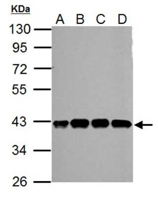 Western Blot: SLFNL1 Antibody [NBP2-20397] - Sample (30 ug of whole cell lysate) A: A549 B: H1299 C: HCT116 D: MCF-7 10% SDS PAGE gel, diluted at 1:10000.
