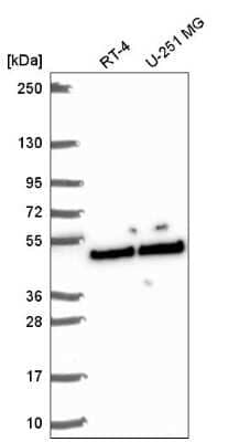Western Blot: SLFNL1 Antibody [NBP2-58744] - Western blot analysis in human cell line RT-4 and human cell line U-251 MG.