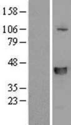 Western Blot: SLFNL1 Overexpression Lysate (Adult Normal) [NBL1-16209] Left-Empty vector transfected control cell lysate (HEK293 cell lysate); Right -Over-expression Lysate for SLFNL1.