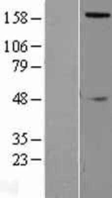 Western Blot: SLIT2 Overexpression Lysate (Adult Normal) [NBL1-16210] Left-Empty vector transfected control cell lysate (HEK293 cell lysate); Right -Over-expression Lysate for SLIT2.