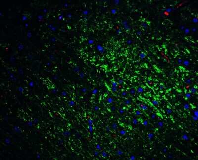 Immunohistochemistry: SLITRK1 Antibody [NBP1-77319] - Immunofluorescence of Slitrk1 in mouse brain tissue with Slitrk1 Antibody at 20 ug/mL. Green: Slitrk1 antibody (NBP1-77319). Red: Phylloidin staining. Blue: DAPI staining.