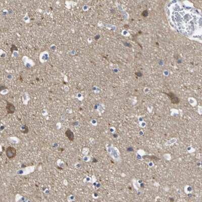 Immunohistochemistry-Paraffin: SLITRK1 Antibody [NBP1-82882] - Staining of human cerebral cortex shows high expression.