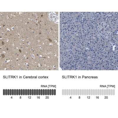 <b>Orthogonal Strategies Validation. </b>Immunohistochemistry-Paraffin: SLITRK1 Antibody [NBP1-82882] - Staining in human cerebral cortex and pancreas tissues using anti-SLITRK1 antibody. Corresponding SLITRK1 RNA-seq data are presented for the same tissues.