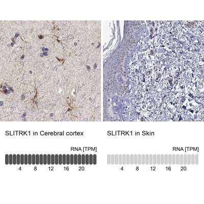 Immunohistochemistry-Paraffin: SLITRK1 Antibody [NBP3-16976] - Analysis in human cerebral cortex and skin tissues using Anti-SLITRK1 antibody. Corresponding SLITRK1 RNA-seq data are presented for the same tissues.