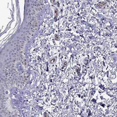 Immunohistochemistry-Paraffin: SLITRK1 Antibody [NBP3-16976] - Staining of human skin shows low expression as expected.