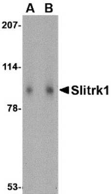 Western Blot: SLITRK1 Antibody [NBP1-77319] - Western blot analysis of SLITRK1 in human brain tissue lysate with SLITRK1 antibody at (A) 1 and (B) 2 ug/mL.