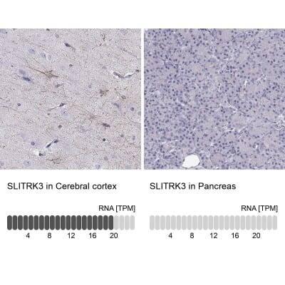 <b>Orthogonal Strategies Validation. </b>Immunohistochemistry-Paraffin: SLITRK3 Antibody [NBP2-62616] - Immunohistochemistry analysis in human cerebral cortex and pancreas tissues using Anti-SLITRK3 antibody. Corresponding SLITRK3 RNA-seq data are presented for the same tissues.