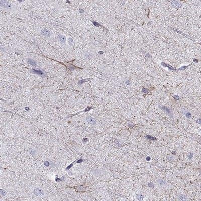 Immunohistochemistry-Paraffin: SLITRK3 Antibody [NBP2-62616] - Staining of human cerebral cortex shows high expression.