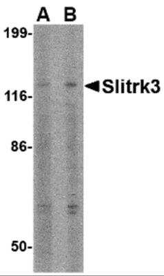 Western Blot: SLITRK3 Antibody [NBP2-81815] - Analysis of SLITRK3 in SK-N-SH cell lysate with SLITRK3 antibody at (A) 0.5 and (B) 1 ug/ml.
