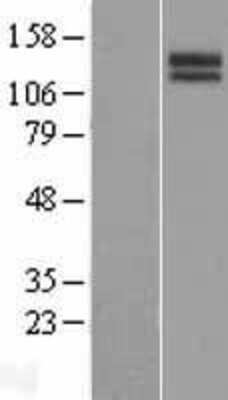 Western Blot: SLITRK3 Overexpression Lysate (Adult Normal) [NBP2-07248] Left-Empty vector transfected control cell lysate (HEK293 cell lysate); Right -Over-expression Lysate for SLITRK3.