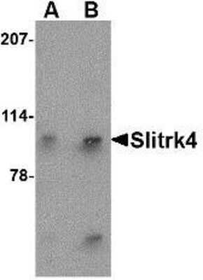 Western Blot: SLITRK4 Antibody [NBP1-76875] - Mouse brain tissue lysate with Slitrk4 antibody at (A) 0.5 and (B) 1 ug/ml.