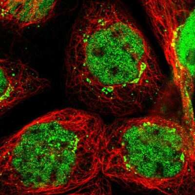 Immunocytochemistry/Immunofluorescence: SLITRK5 Antibody [NBP1-90798] - Immunofluorescent staining of human cell line A-431 shows localization to nucleoplasm & the Golgi apparatus.