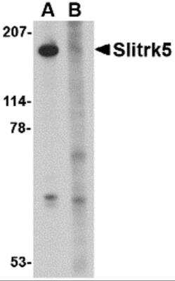 Western Blot: SLITRK5 Antibody [NBP2-81915] - Analysis of SLITRK5 in 3T3 cell lysate with SLITRK5 antibody at 1 ug/ml in the (A) absence or (B) presence of blocking peptide.