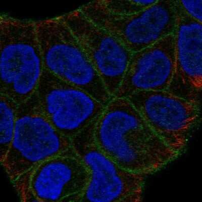 Immunocytochemistry/Immunofluorescence: SLITRK6 Antibody [NBP2-58375] - Staining of human cell line RT4 shows localization to plasma membrane.