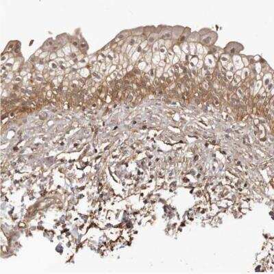 Immunohistochemistry-Paraffin: SLITRK6 Antibody [NBP1-82107] - Staining of human urinary bladder shows moderate cytoplasmic and membranous positivity in urothelial cells.