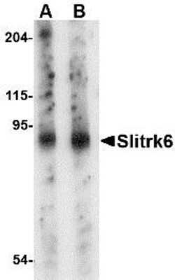 Western Blot: SLITRK6 Antibody [NBP1-76877] - Mouse lung tissue lysate with Slitrk6 antibody at (A) 0.5 and (B) 1 ug/ml.