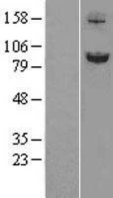 Western Blot: SLITRK6 Overexpression Lysate (Adult Normal) [NBL1-16212] Left-Empty vector transfected control cell lysate (HEK293 cell lysate); Right -Over-expression Lysate for SLITRK6.