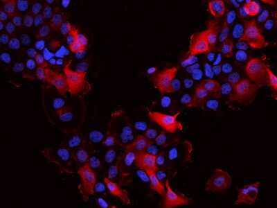 Immunocytochemistry/Immunofluorescence: SLK Antibody [NBP2-98482] - Immunofluorescence staining of SLK in A431 cells. Cells were fixed with 4% PFA, permeabilzed with 0.1% Triton X-100 in PBS, blocked with 10% serum, and incubated with rabbit anti-Human SLK polyclonal antibody (dilution ratio 1:200) at 4C overnight. Then cells were stained with the Alexa Fluor(R)594-conjugated Goat Anti-rabbit IgG secondary antibody (red) and counterstained with DAPI (blue).Positive staining was localized to Cytoplasm and cell membrane.