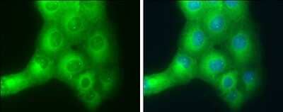 Immunocytochemistry/Immunofluorescence: SLK Antibody [NBP3-13025] - SLK antibody detects SLK protein at cytoplasm by immunofluorescent analysis. Sample: H1299 cells were fixed in 4% paraformaldehyde at RT for 15 min. Green: SLK protein stained by SLK antibody (NBP3-13025) diluted at 1:500. Blue: Hoechst 33342 staining.