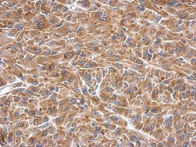 Immunohistochemistry-Paraffin: SLK Antibody [NBP2-20401] - Immunohistochemical analysis of paraffin-embedded U87 xenograft, using antibody at 1:500 dilution.