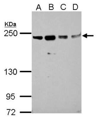 Western Blot: SLK Antibody [NBP2-20401] - Sample (30 ug of whole cell lysate) A: A549 B: H1299 C: HCT116 D: MCF-7 5% SDS PAGE gel, diluted at 1:1000.