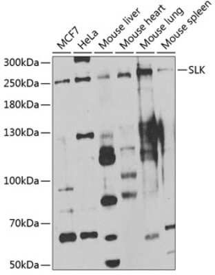 Western Blot: SLK Antibody [NBP3-04553] - Analysis of extracts of various cell lines, using SLK antibody at 1:1000 dilution. Secondary antibody: HRP Goat Anti-Rabbit IgG (H+L) at 1:10000 dilution. Lysates/proteins: 25ug per lane. Blocking buffer: 3% nonfat dry milk in TBST. Detection: ECL Enhanced Kit