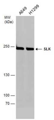 Western Blot: SLK Antibody [NBP3-13025] - Various whole cell extracts (30 ug) were separated by 5% SDS-PAGE, and the membrane was blotted with SLK antibody (NBP3-13025) diluted at 1:1000.