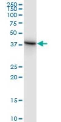 Western Blot: SLP-2 Antibody [H00030968-B01P] - Analysis of STOML2 expression in A-431.