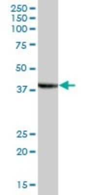 Western Blot: SLP-2 Antibody [H00030968-B01P] - Analysis of STOML2 expression in human placenta.