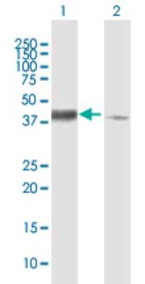 Western Blot: SLP-2 Antibody [H00030968-B01P] - Analysis of STOML2 expression in transfected 293T cell line by STOML2 polyclonal antibody.  Lane 1: STOML2 transfected lysate(39.16 KDa). Lane 2: Non-transfected lysate.