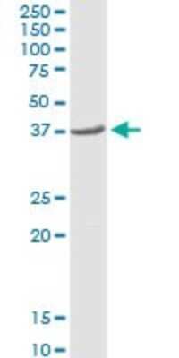 Western Blot: SLP-2 Antibody [H00030968-D01P] - Analysis of STOML2 expression in human kidney.