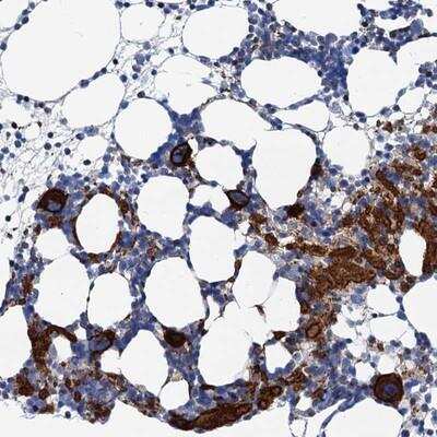 Immunohistochemistry: SLP-76/LCP2 Antibody [NBP1-87032] - Staining of human bone marrow shows strong cytoplasmic positivity in Megakaryocytes.