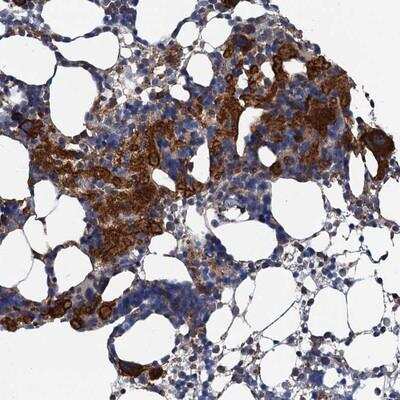 Immunohistochemistry: SLP-76/LCP2 Antibody [NBP1-87033] - Staining of human bone marrow shows strong cytoplasmic positivity in bone marrow poietic cells.