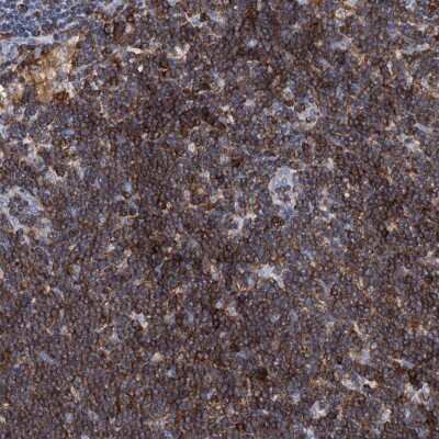 Immunohistochemistry-Paraffin: SLP-76/LCP2 Antibody [NBP1-87032] - Staining of human lymph node shows high expression.